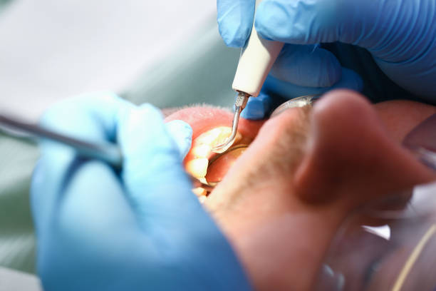 Best Affordable Emergency Dental Care  in Burlington, ND