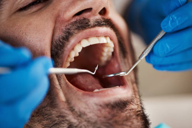 Best Dentist for Severe Toothache  in Burlington, ND