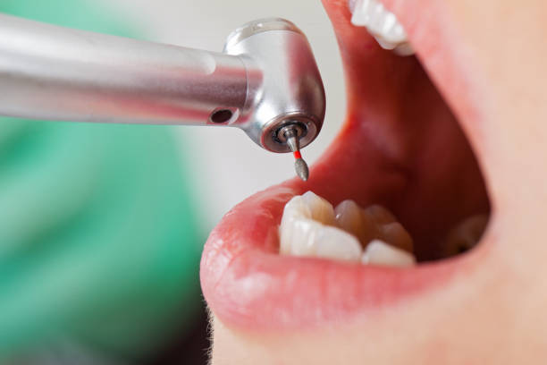Best Knocked-Out Tooth Emergency  in Burlington, ND